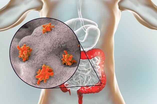 Tipos de parásitos en humanos.