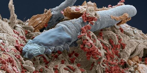 Demodex