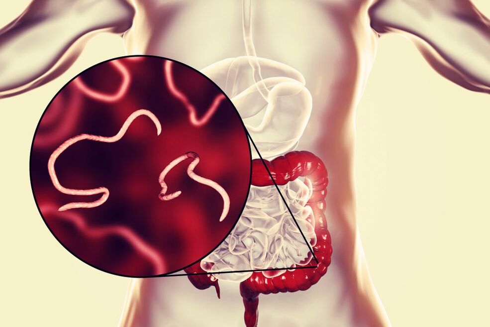 Gusanos en el intestino humano.
